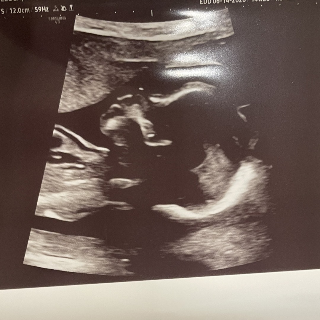 Photo shared by Kathy for their Babylist baby registry.