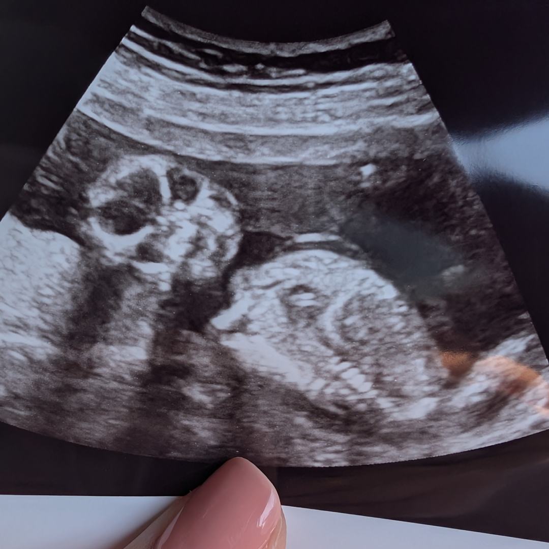 Photo shared by Asher for their Babylist baby registry.