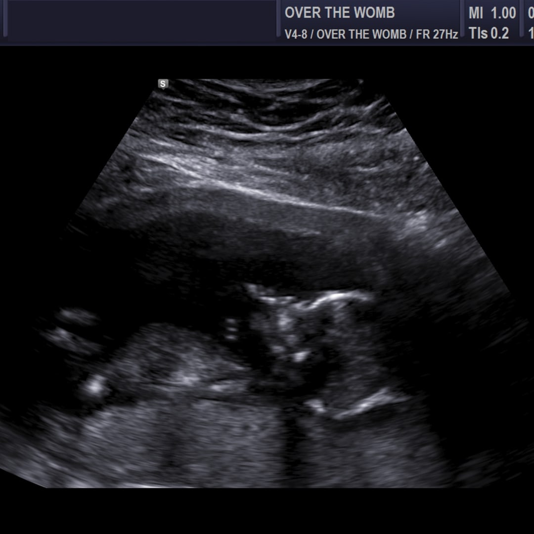 Photo shared by Courtney for their Babylist baby registry.