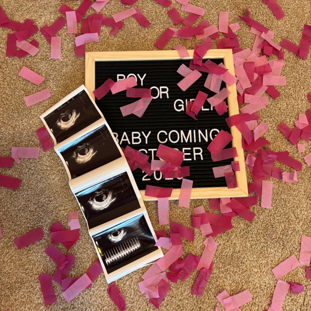 Photo shared by Lauren for their Babylist baby registry.