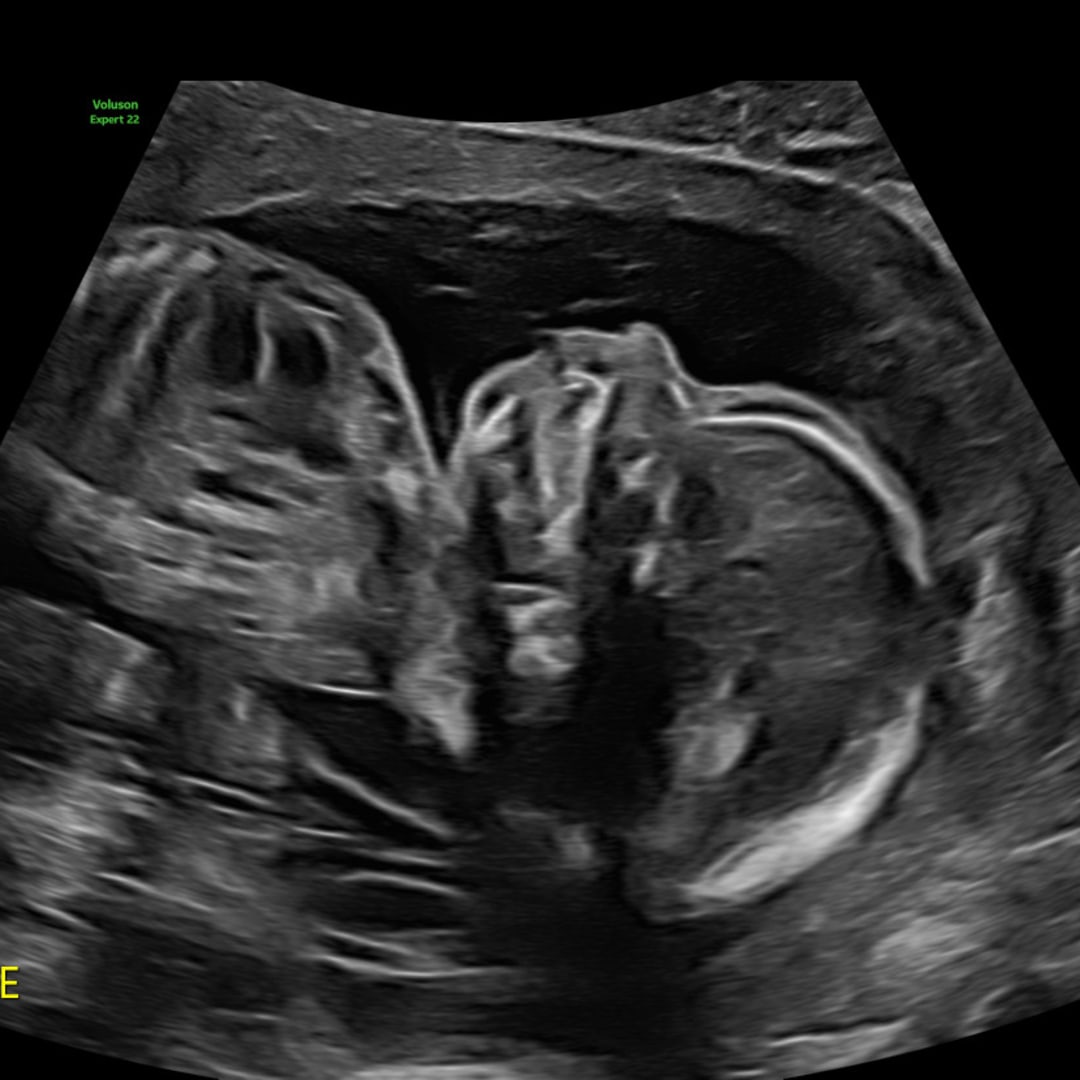 Photo shared by Jd for their Babylist baby registry.