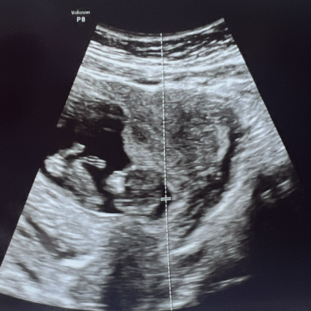 Photo shared by Brooke for their Babylist baby registry.