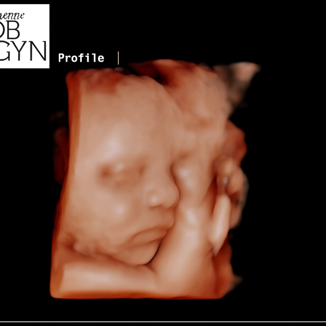 Photo shared by Josie for their Babylist baby registry.