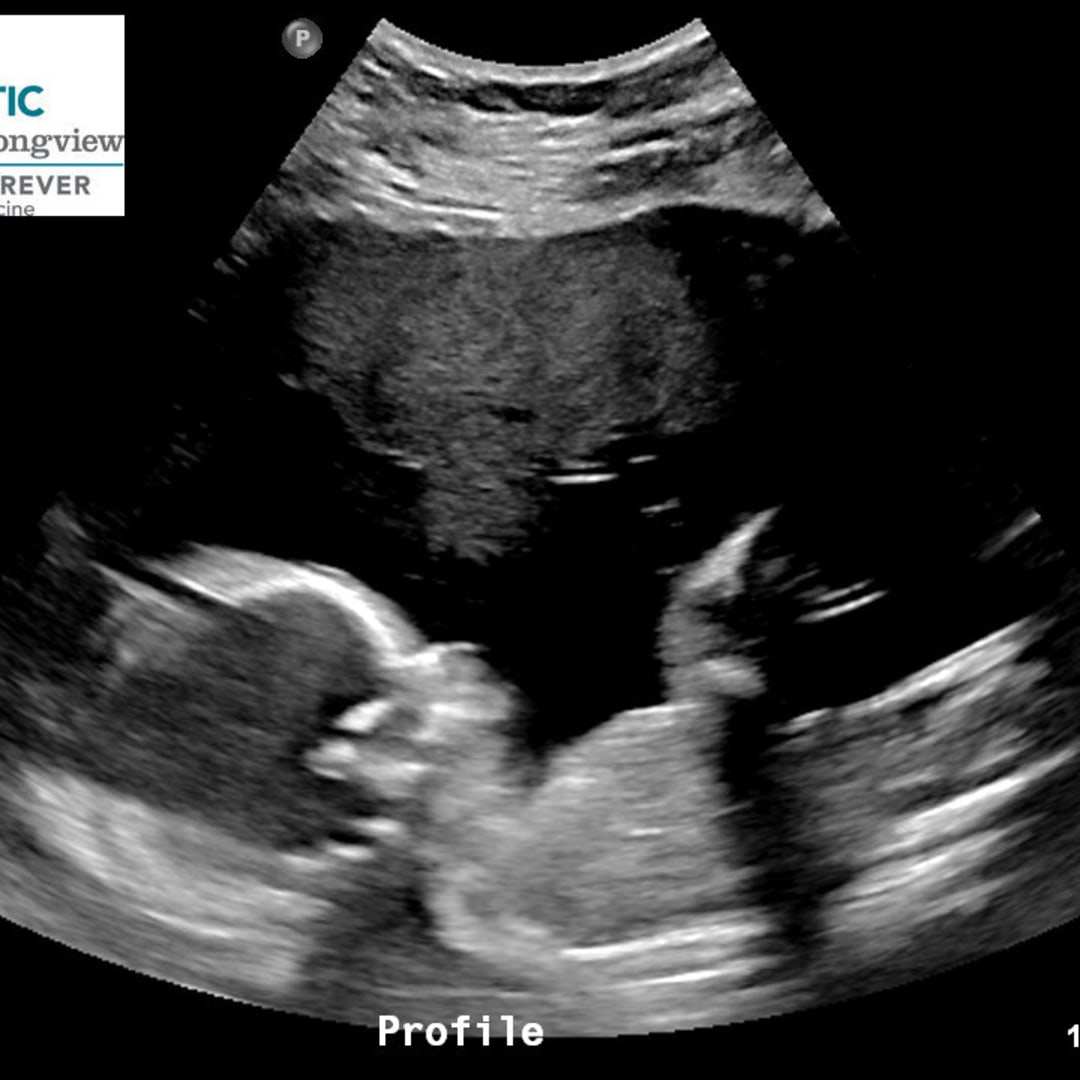 Photo shared by Angelica for their Babylist baby registry.