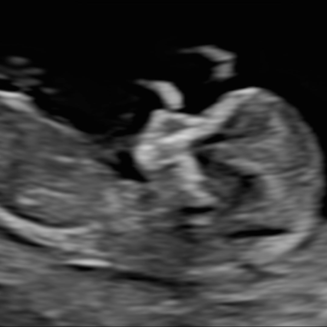 Photo shared by Allison for their Babylist baby registry.