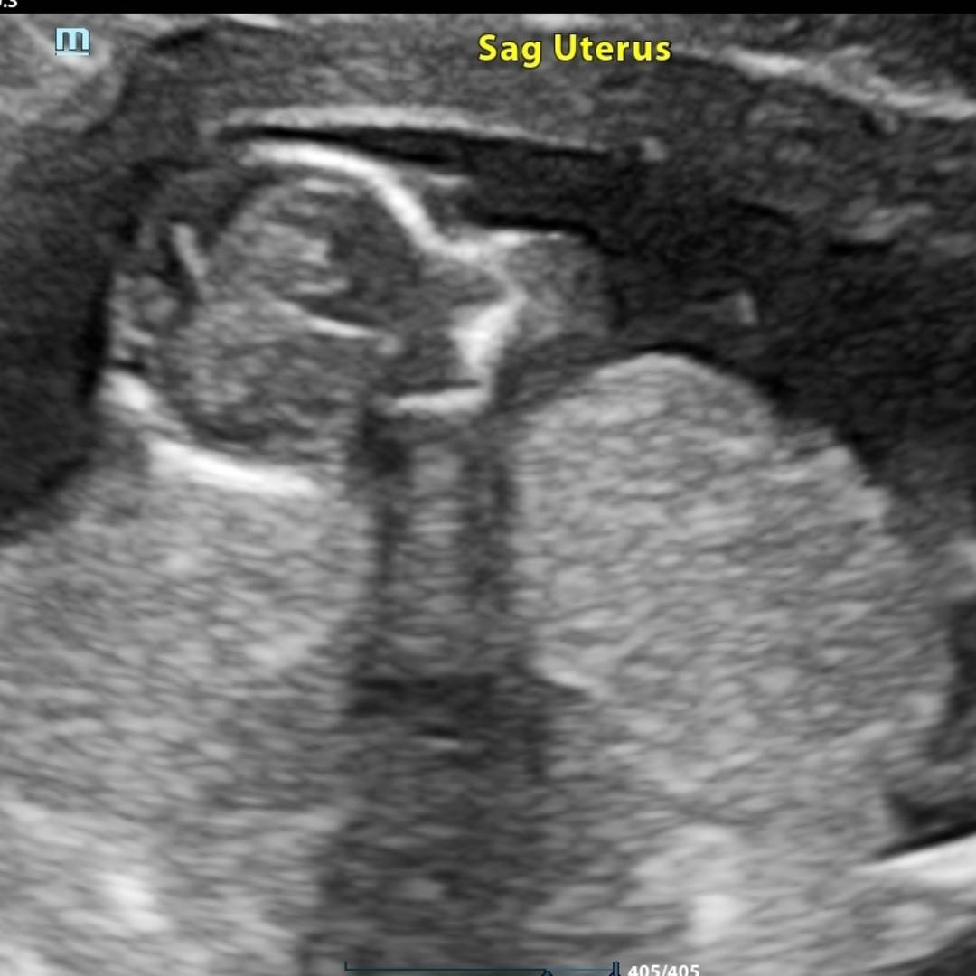 Photo shared by JOHANNA for their Babylist baby registry.