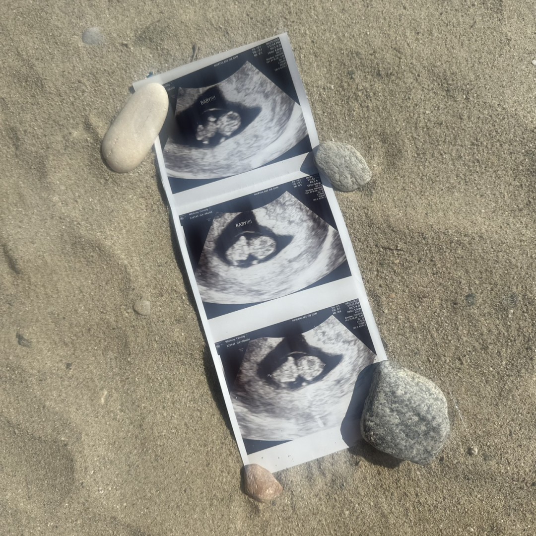 Photo shared by Cassidy for their Babylist baby registry.