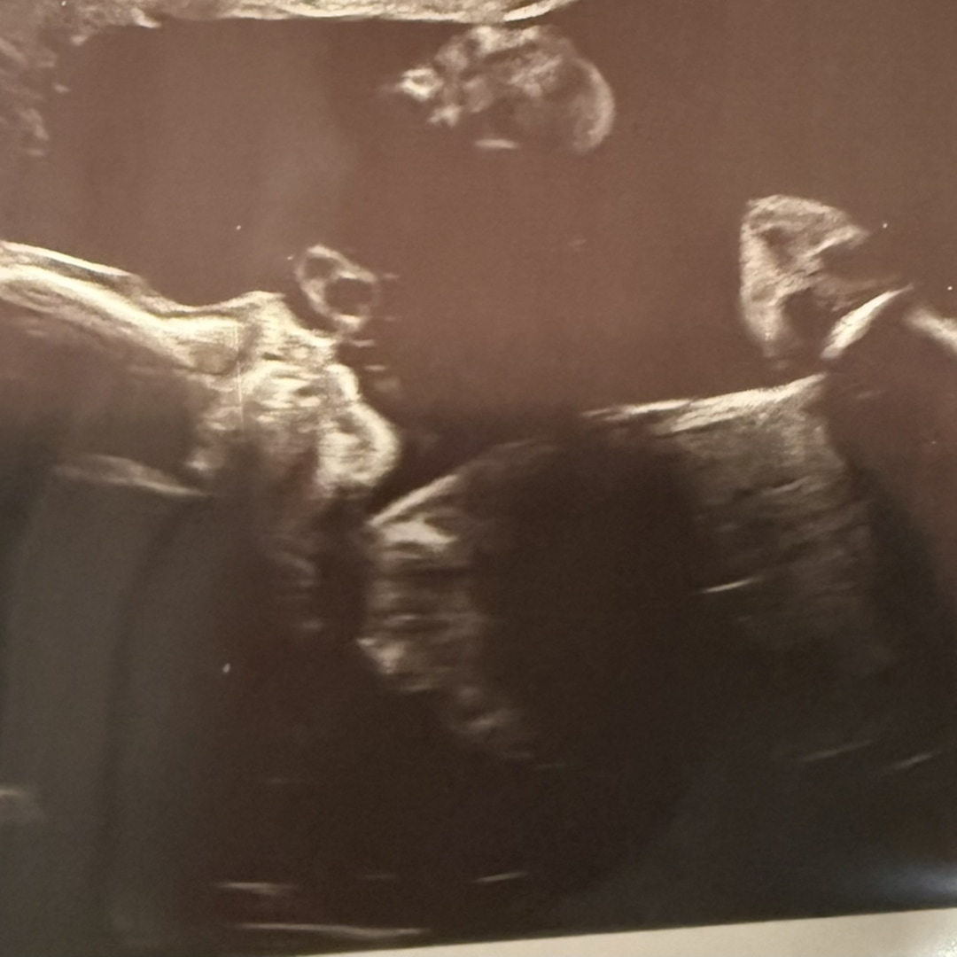 Photo shared by Elizabeth for their Babylist baby registry.