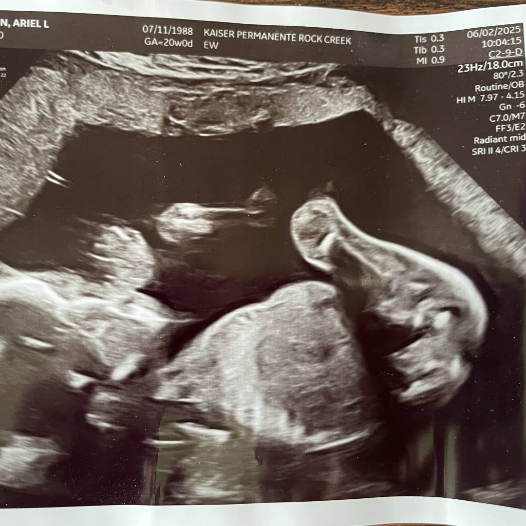 Photo shared by Ariel for their Babylist baby registry.