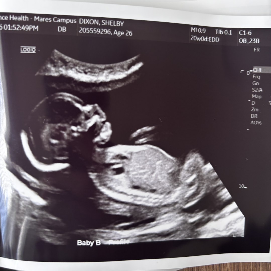 Photo shared by Shelby for their Babylist baby registry.
