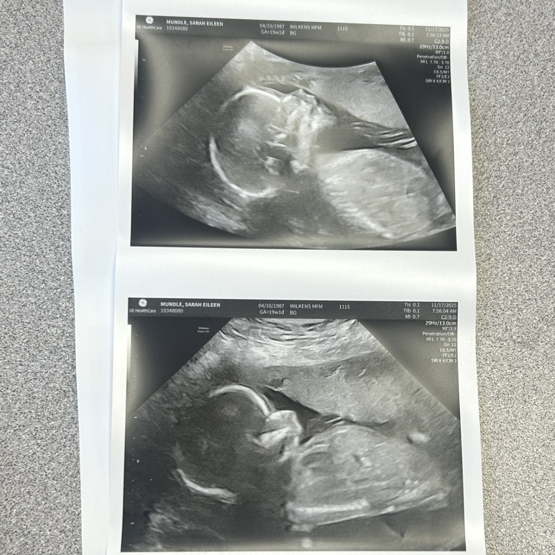 Photo shared by Sarah for their Babylist baby registry.