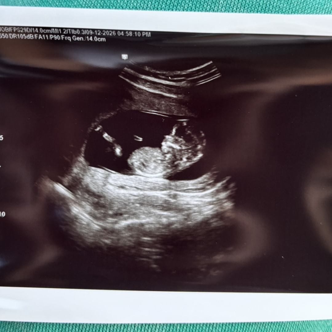 Photo shared by Charlie for their Babylist baby registry.