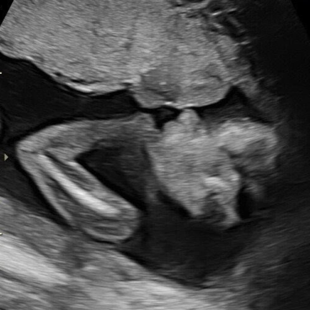 Photo shared by Chelsi for their Babylist baby registry.