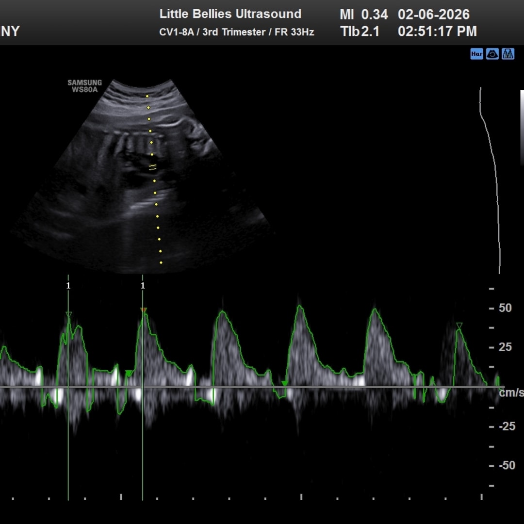Photo shared by Destiny for their Babylist baby registry.