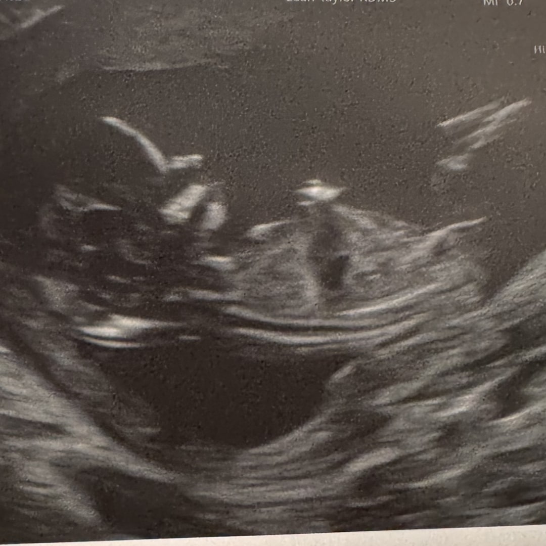 Photo shared by Madilyn for their Babylist baby registry.