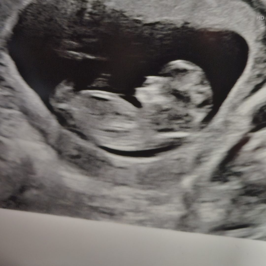 Photo shared by Amber for their Babylist baby registry.