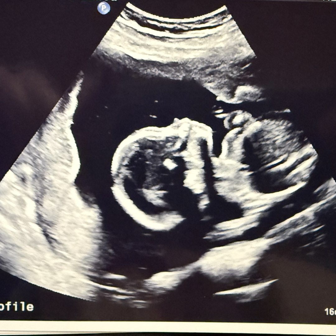 Photo shared by Cassandra for their Babylist baby registry.