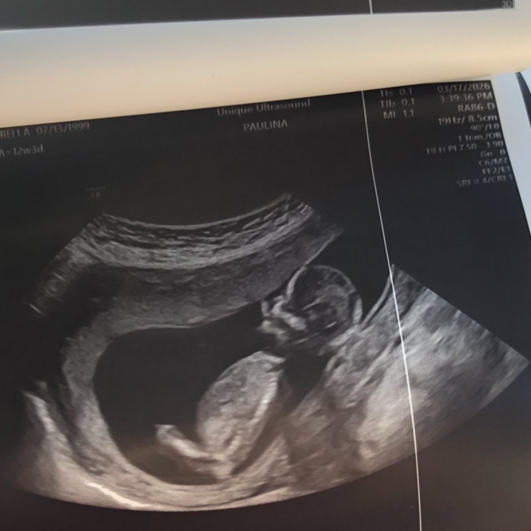 Photo shared by Isabella for their Babylist baby registry.