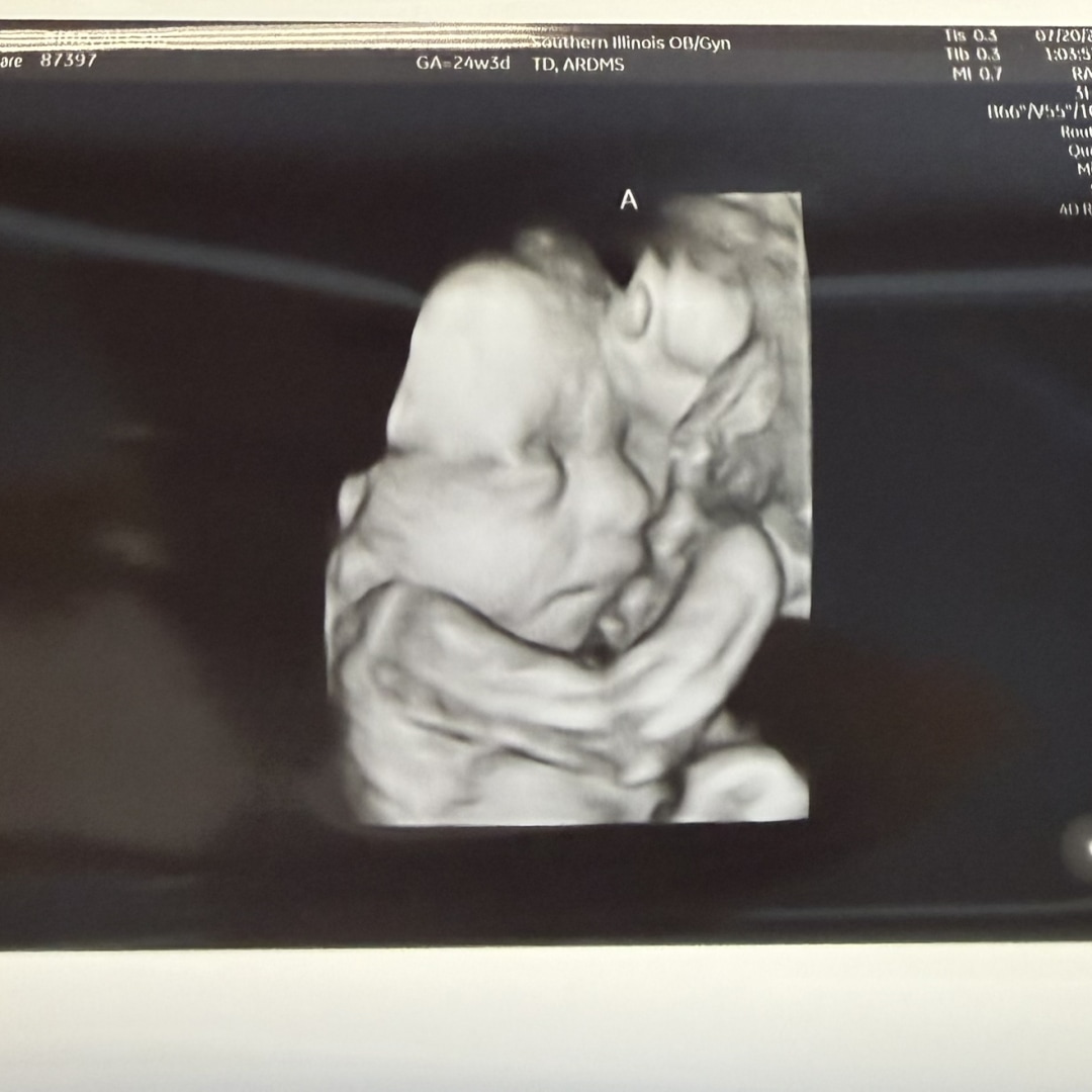Photo shared by Alexis for their Babylist baby registry.