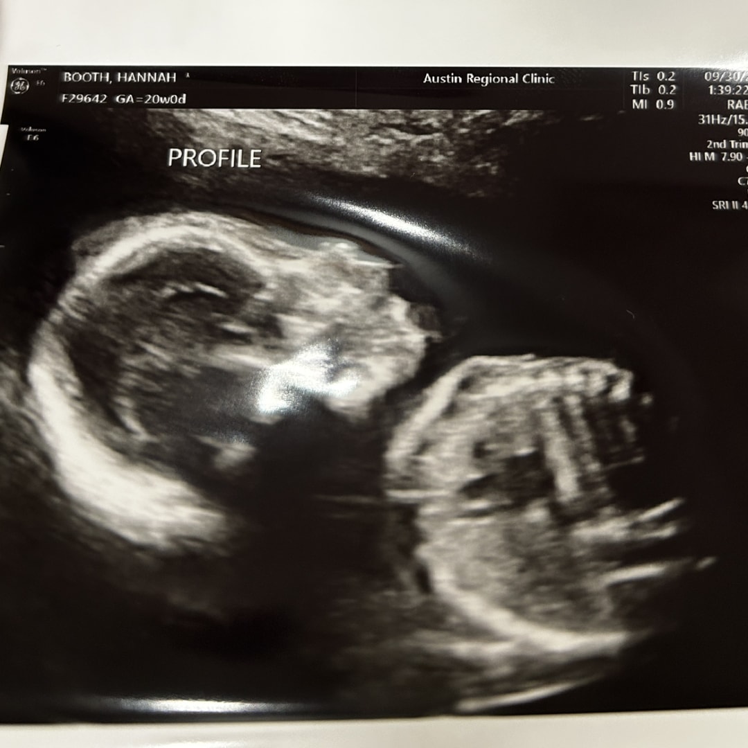 Photo shared by Hannah for their Babylist baby registry.