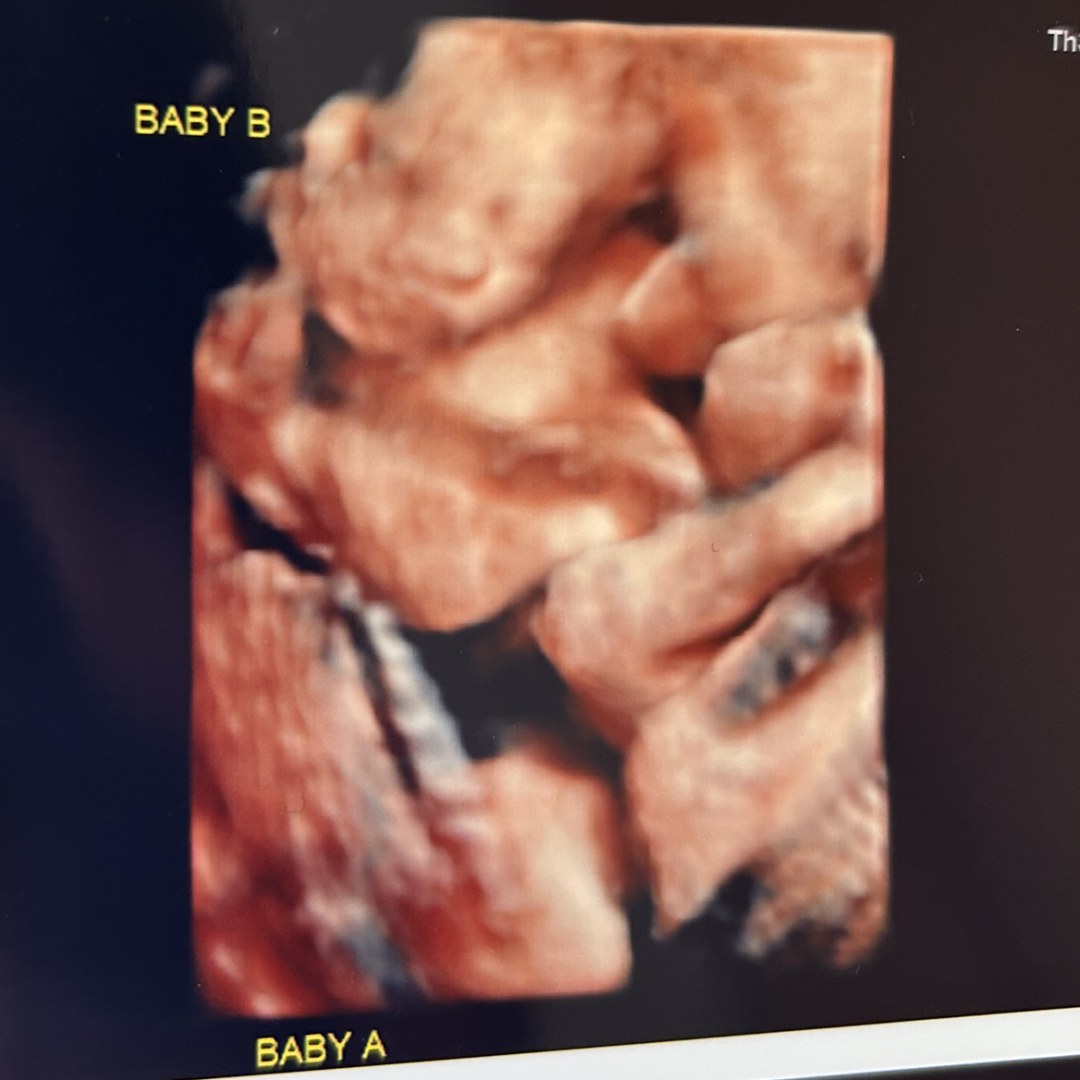 Photo shared by Jami for their Babylist baby registry.