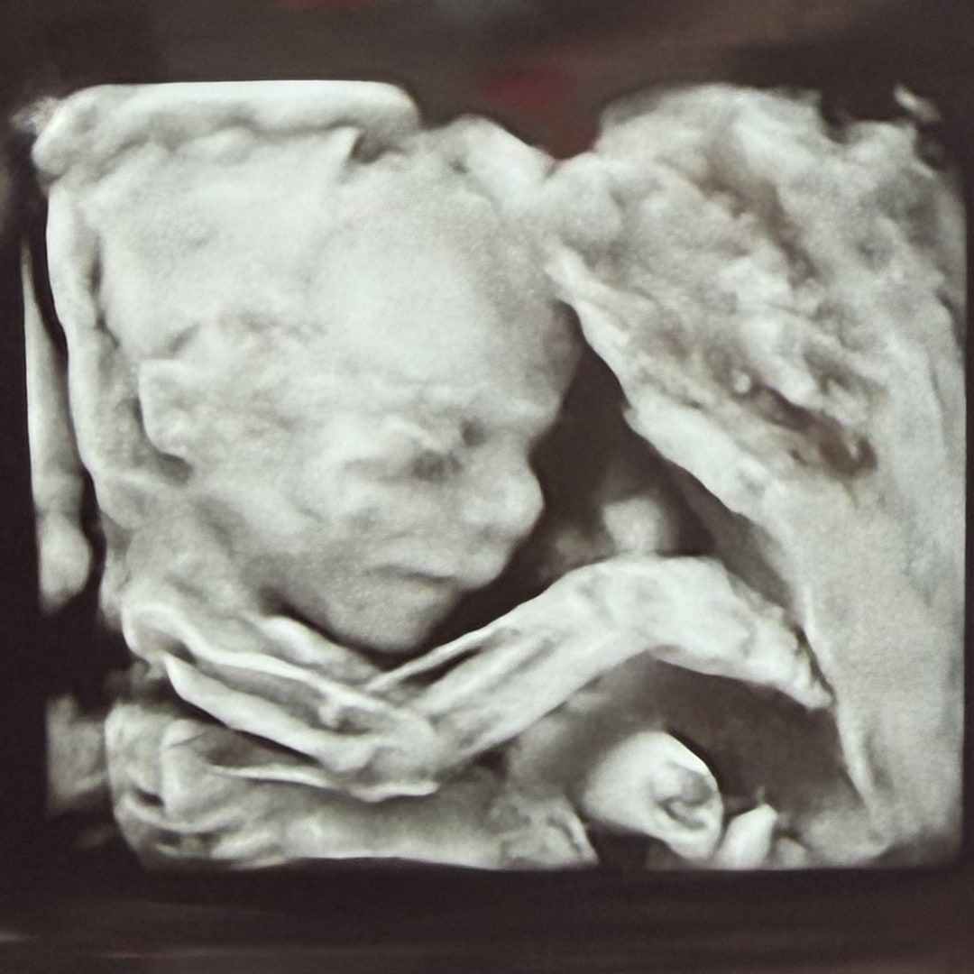 Photo shared by Abigail for their Babylist baby registry.