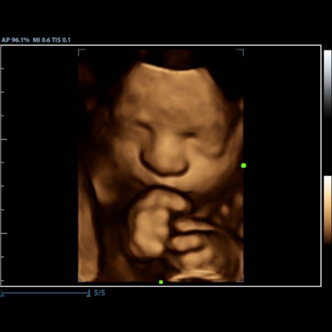 Photo shared by Chloe for their Babylist baby registry.