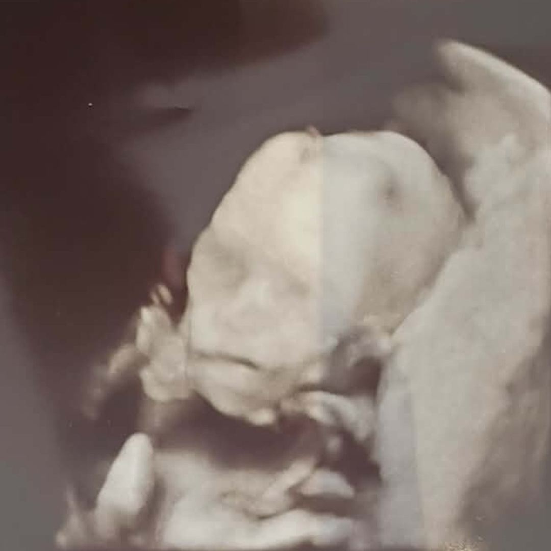 Photo shared by August for their Babylist baby registry.