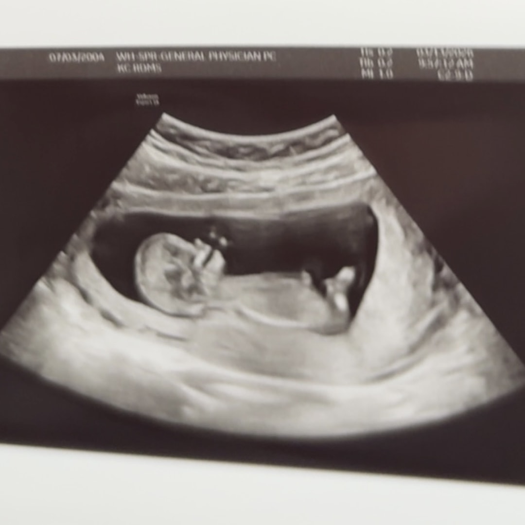 Photo shared by Brina for their Babylist baby registry.