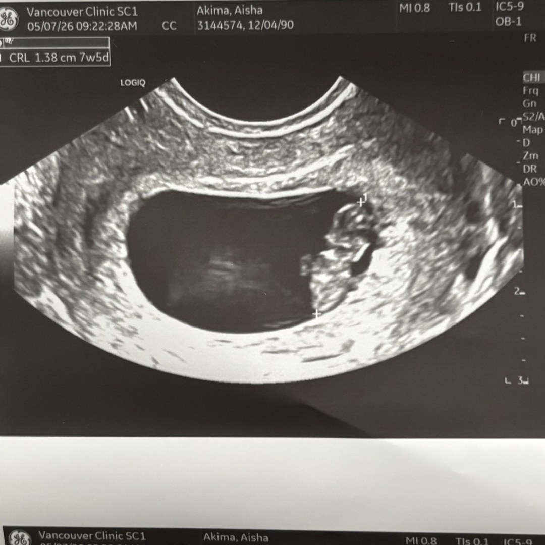 Photo shared by Aisha for their Babylist baby registry.