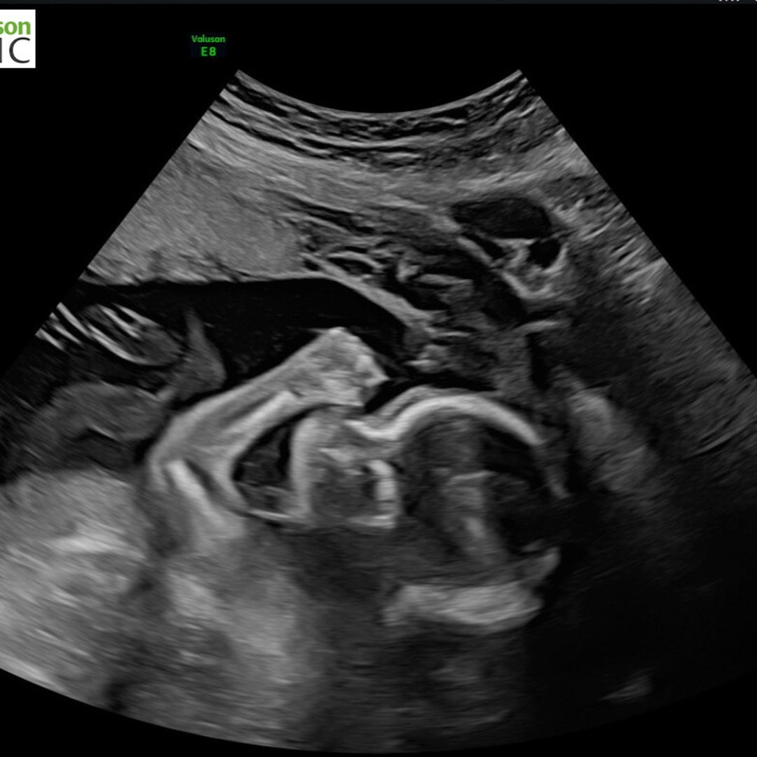 Photo shared by Amber for their Babylist baby registry.