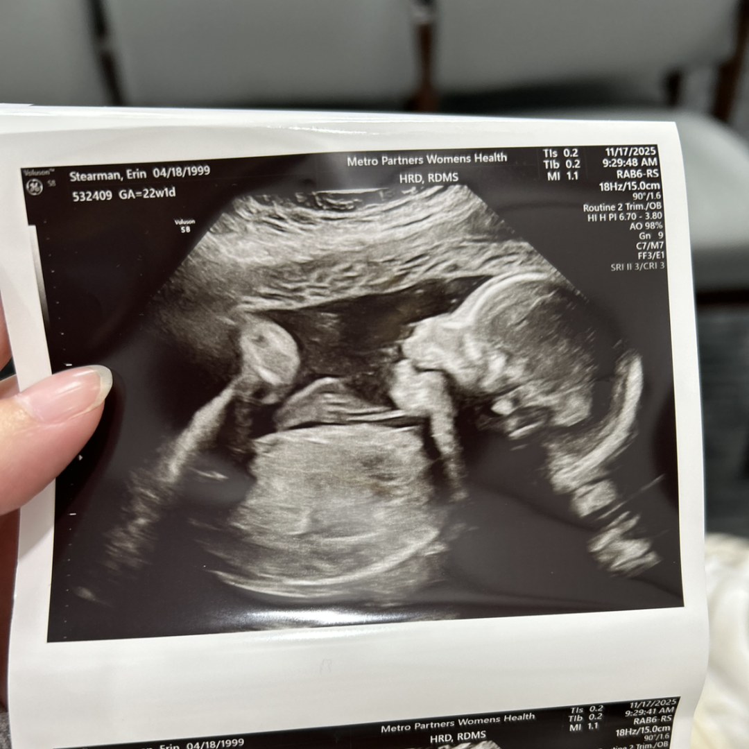 Photo shared by Erin for their Babylist baby registry.