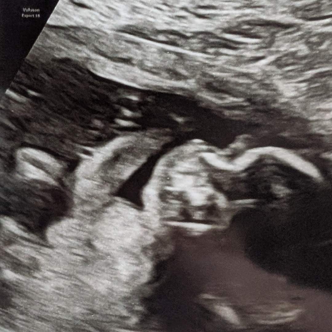 Photo shared by Alissa for their Babylist baby registry.