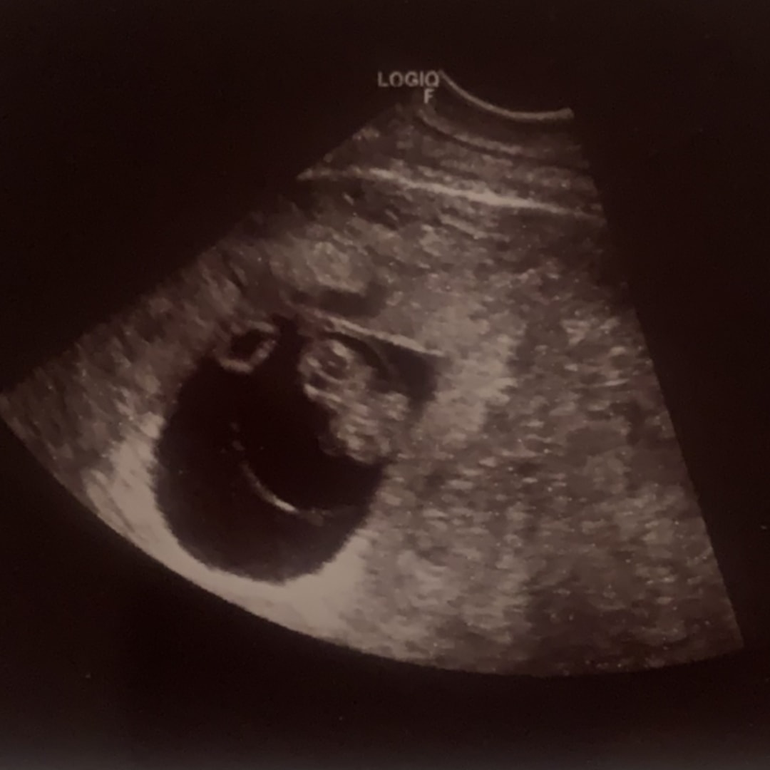 Photo shared by Jaylssa for their Babylist baby registry.