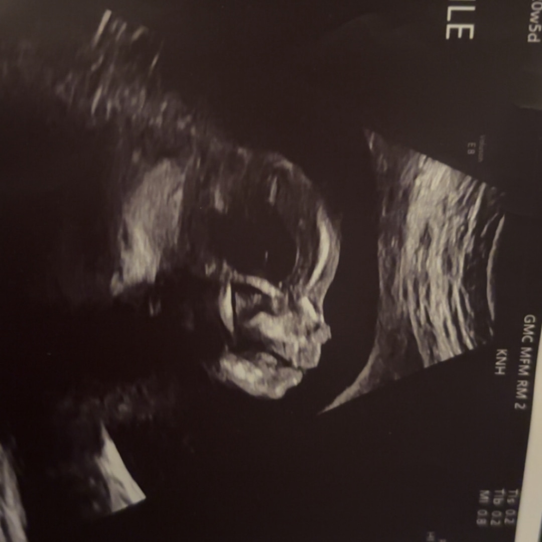 Photo shared by Patricia for their Babylist baby registry.