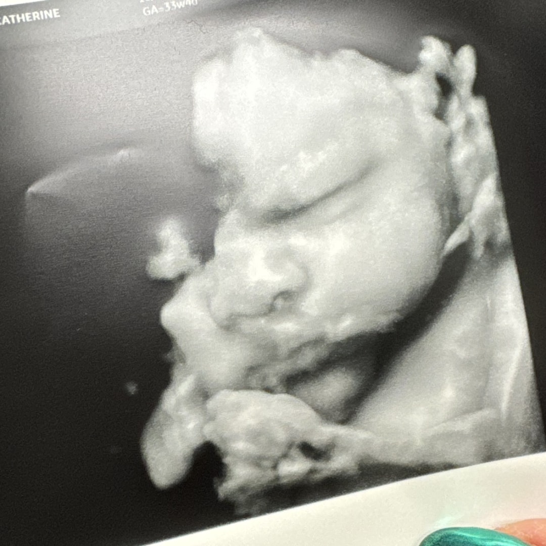 Photo shared by Catherine for their Babylist baby registry.