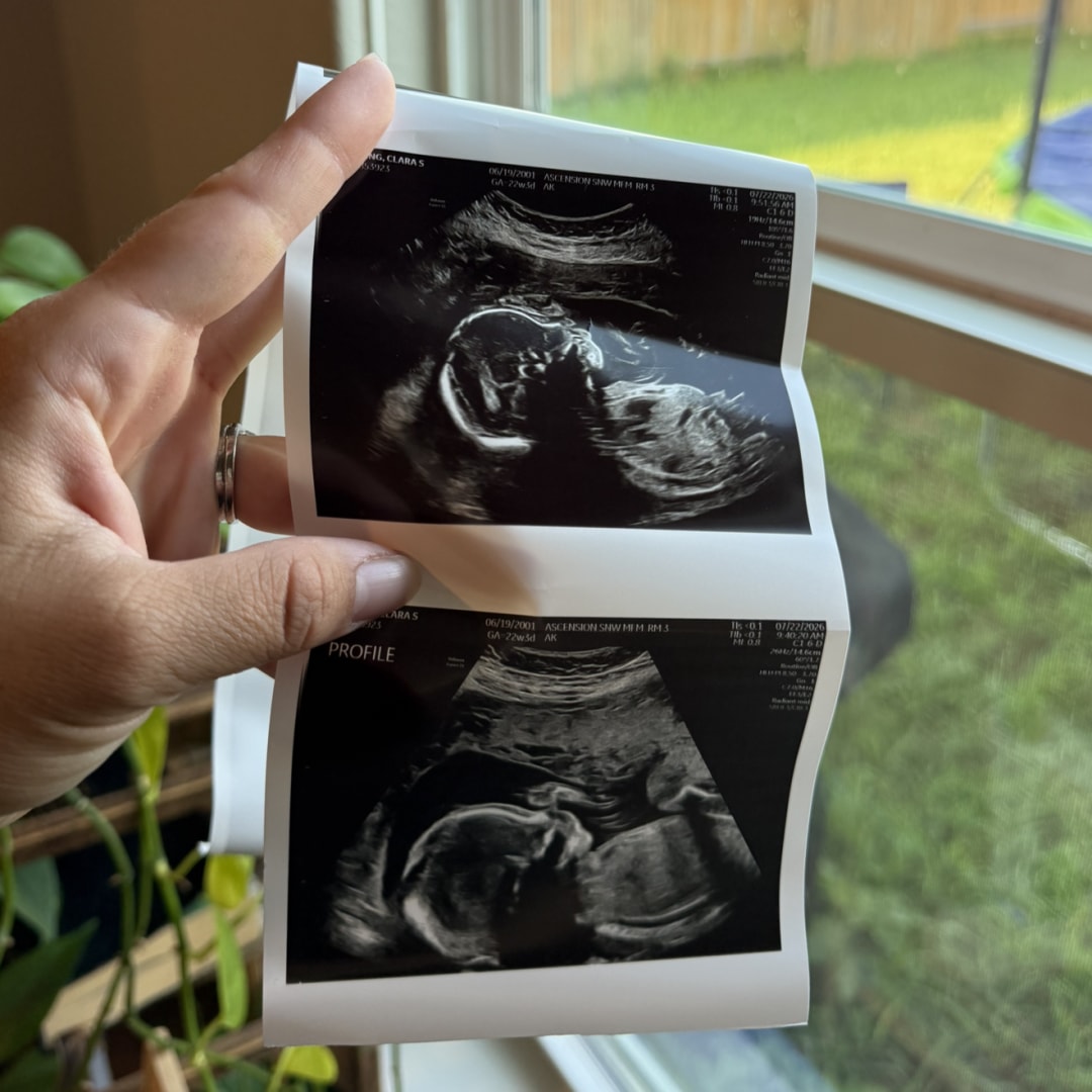 Photo shared by Clara for their Babylist baby registry.
