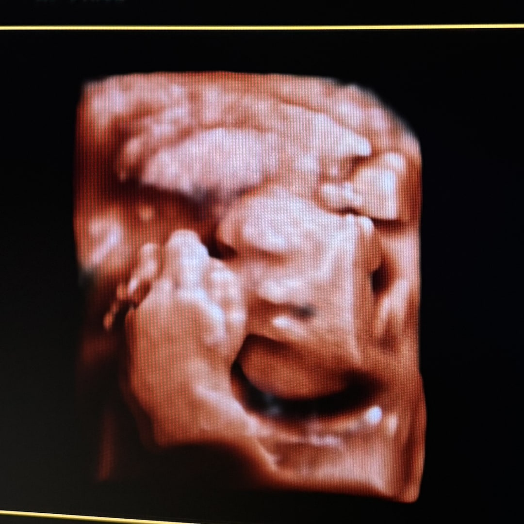 Photo shared by Genesis for their Babylist baby registry.