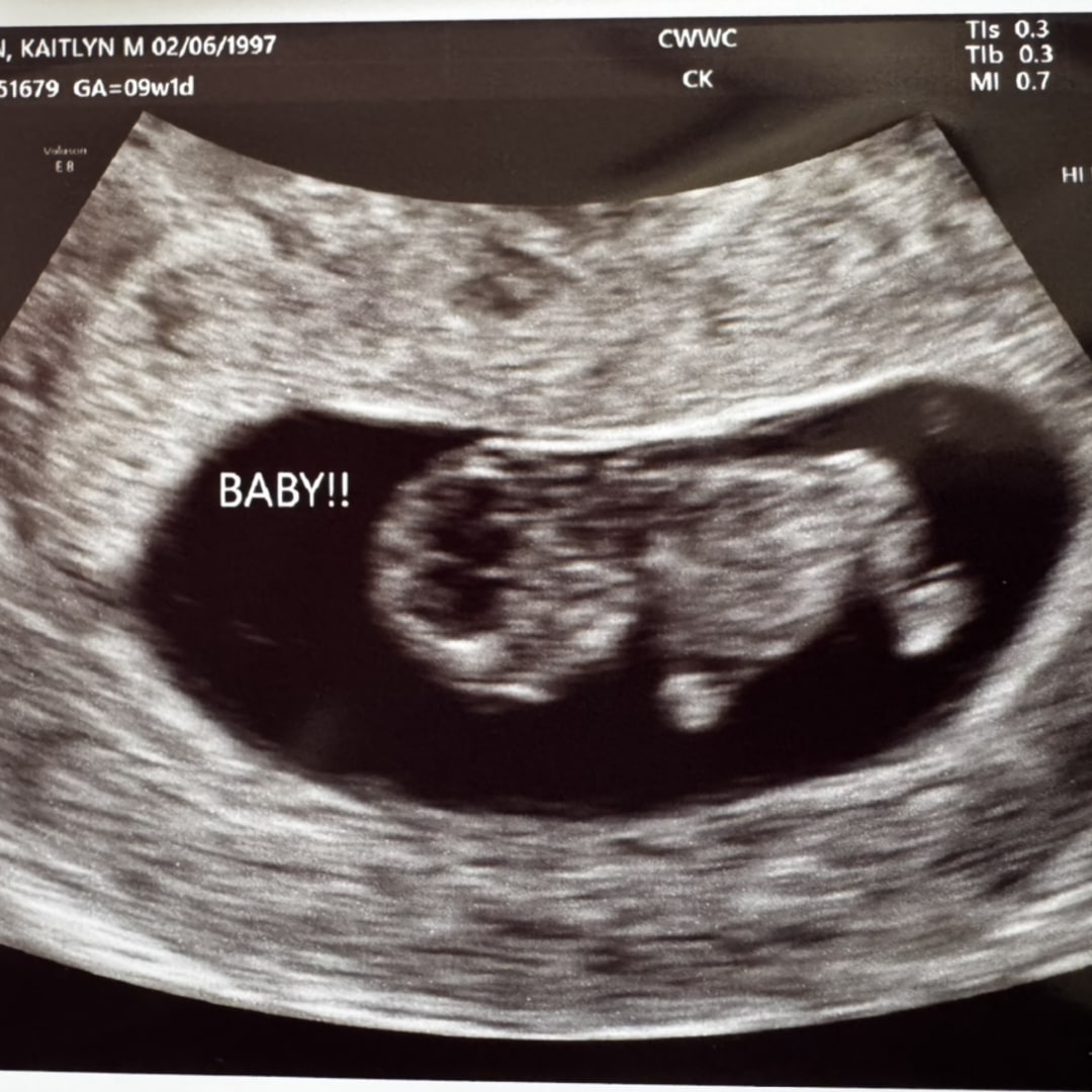Photo shared by Kaitlyn for their Babylist baby registry.