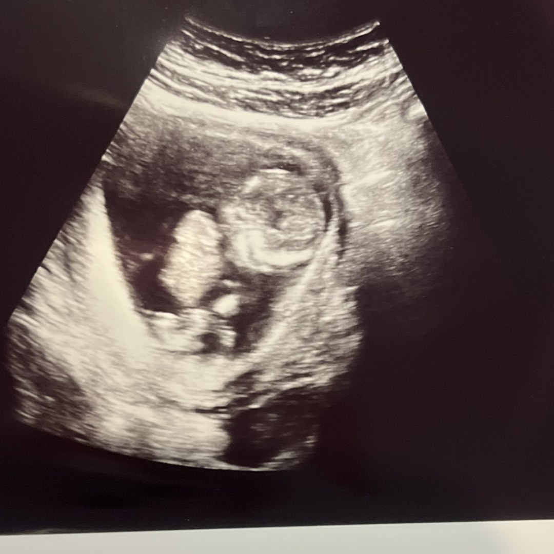 Photo shared by Chloe for their Babylist baby registry.