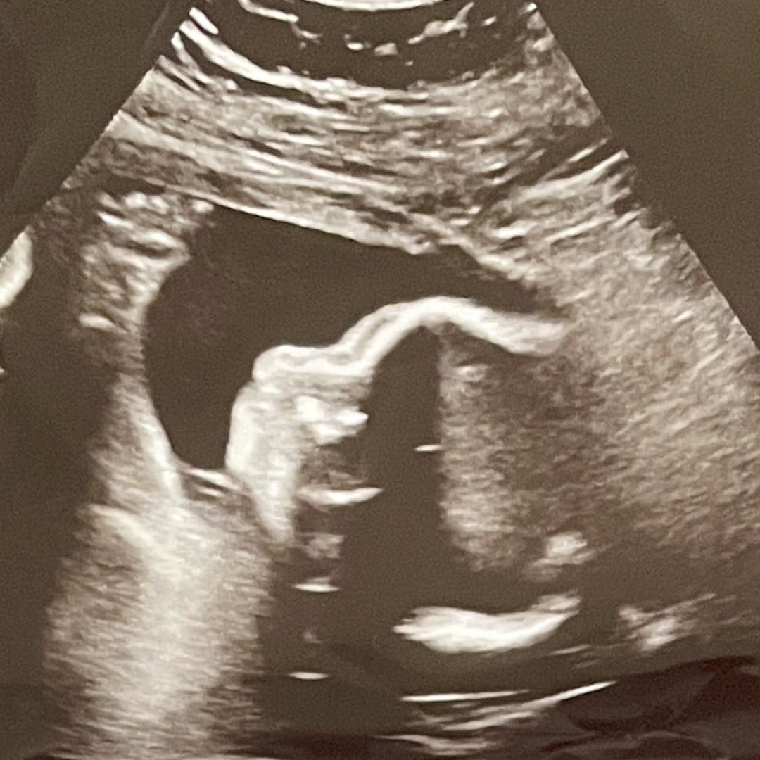 Photo shared by Stacy for their Babylist baby registry.