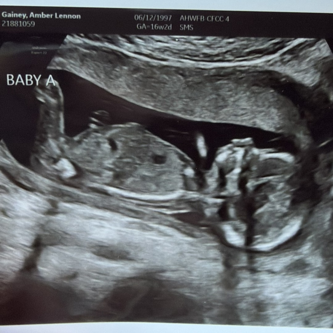 Photo shared by Amber for their Babylist baby registry.