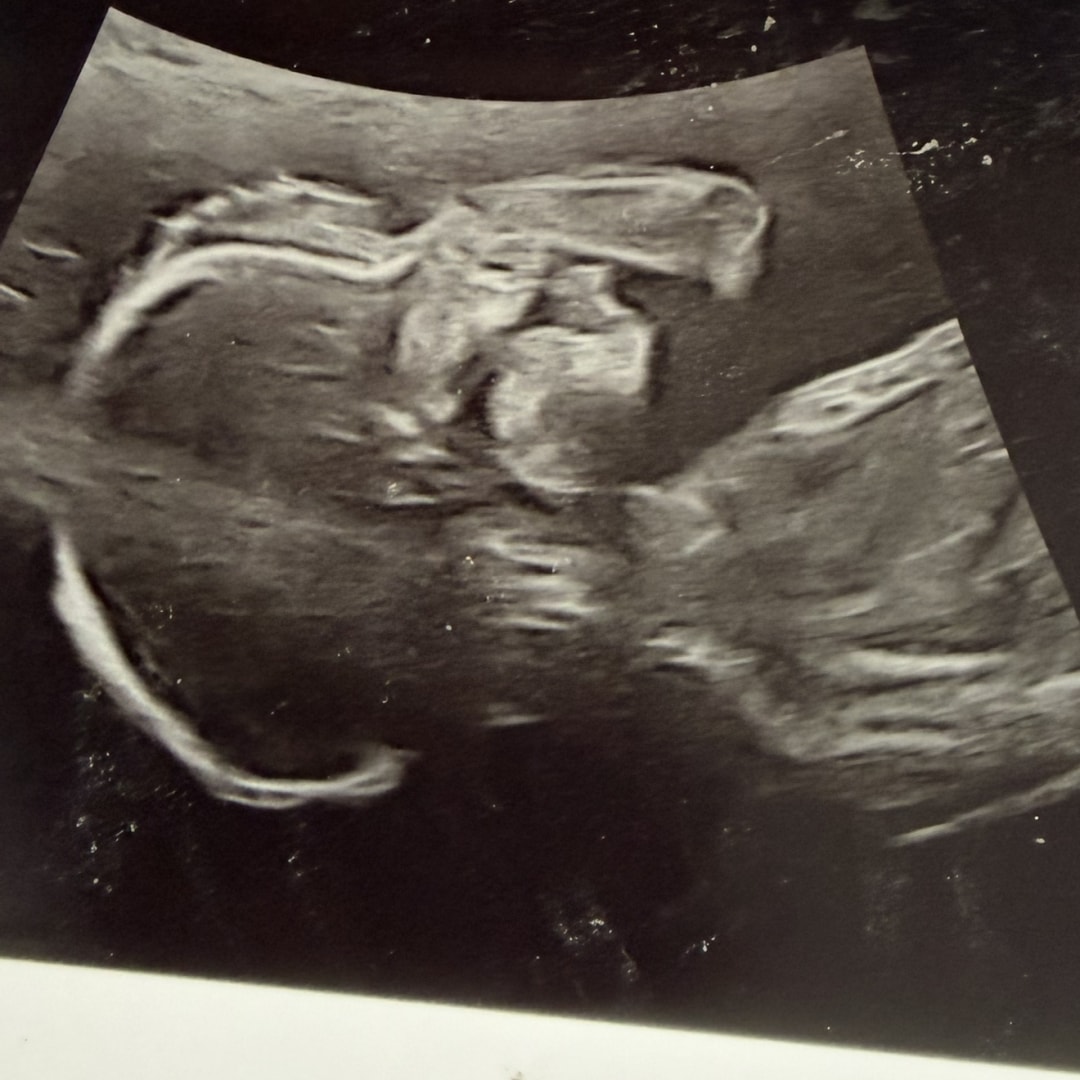Photo shared by Olyvia for their Babylist baby registry.