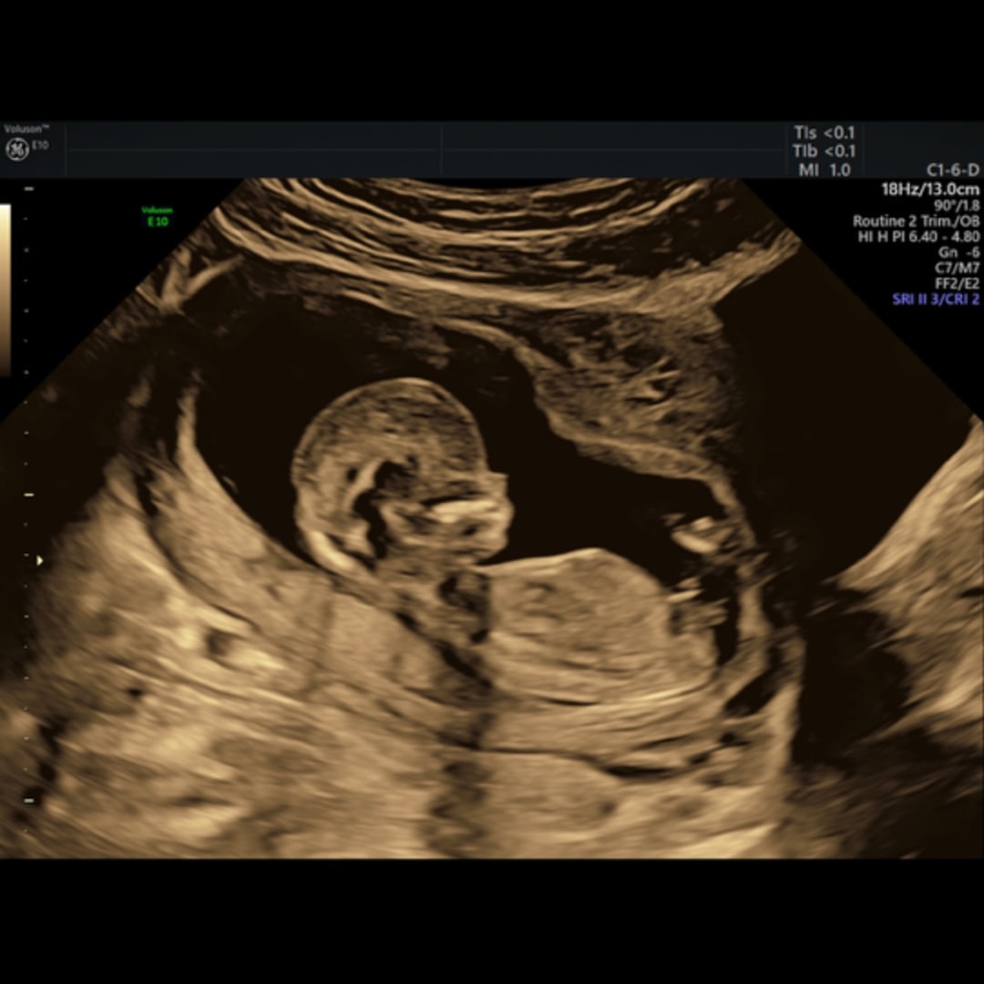 Photo shared by Heather for their Babylist baby registry.