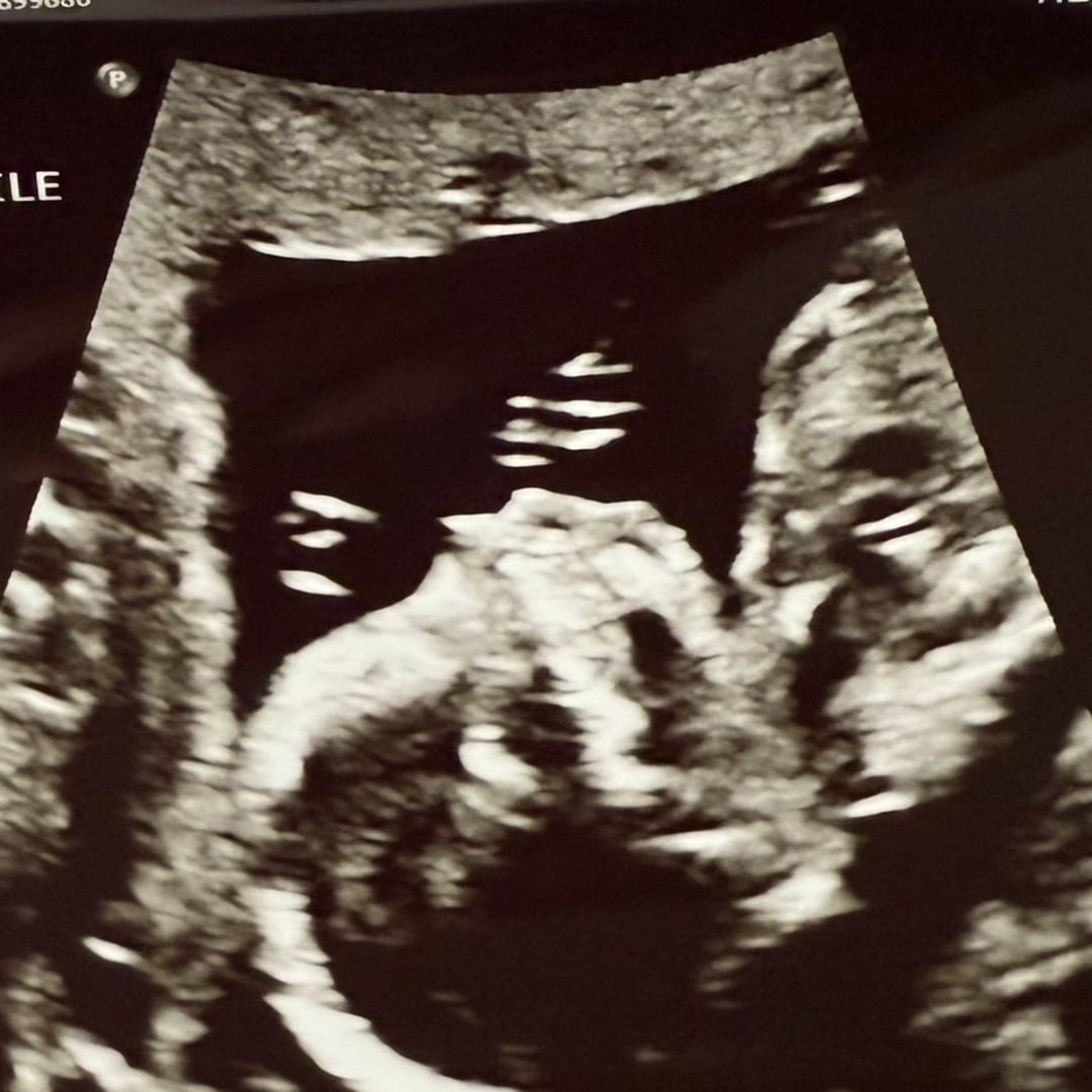 Photo shared by Erin for their Babylist baby registry.