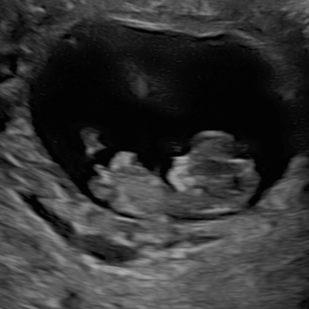 Photo shared by Micah for their Babylist baby registry.