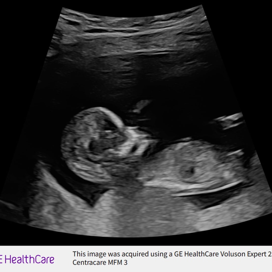 Photo shared by Emma for their Babylist baby registry.