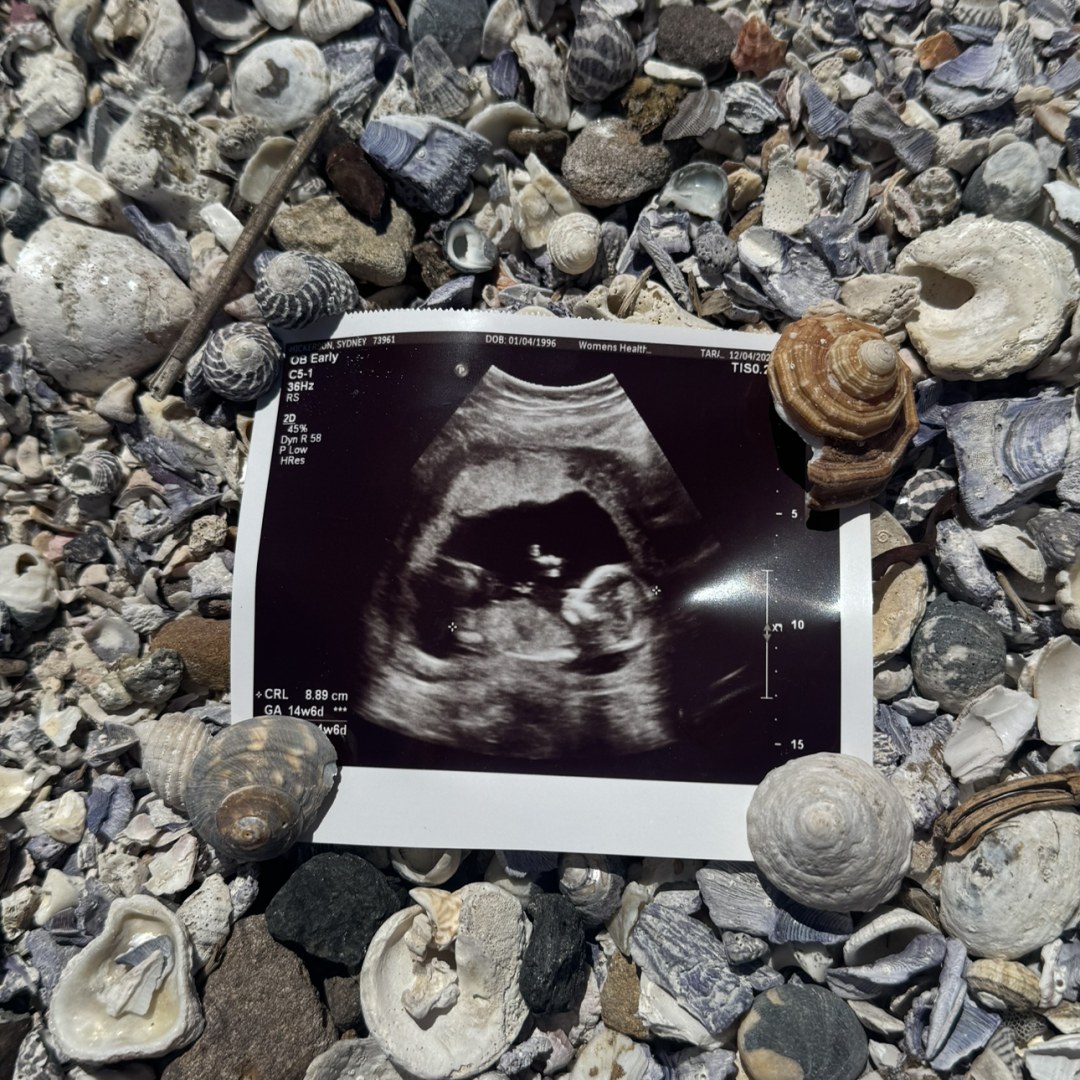 Photo shared by Sydney for their Babylist baby registry.