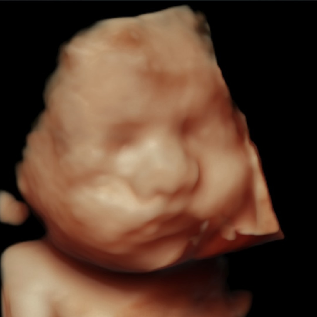 Photo shared by Katy for their Babylist baby registry.