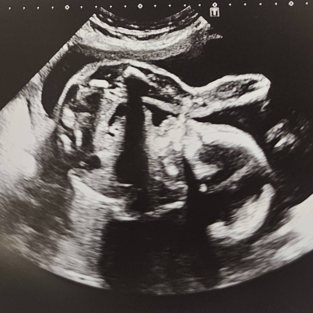 Photo shared by Rhiannon for their Babylist baby registry.